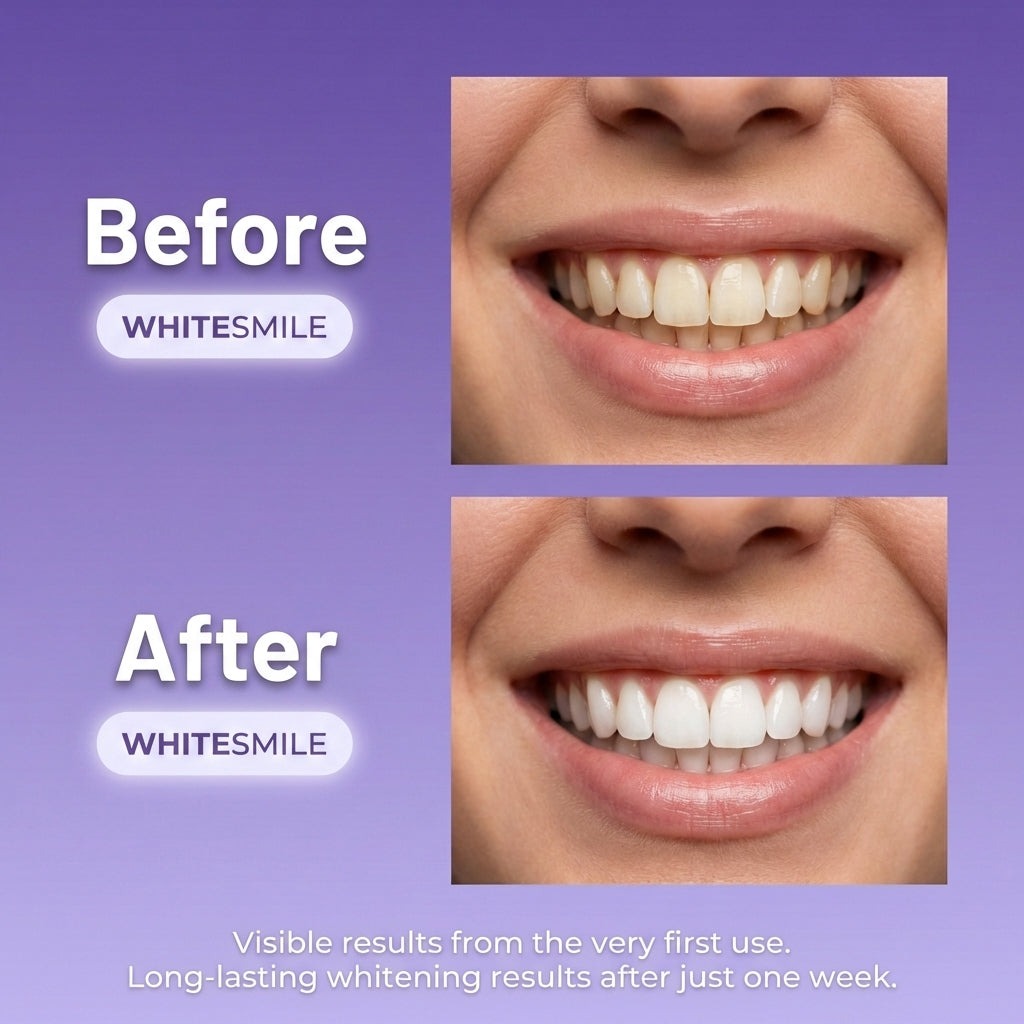 White Smile Whitening Strips